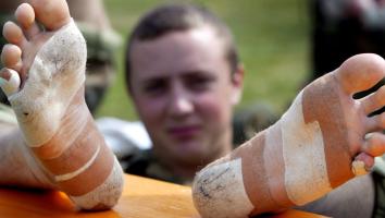 zere voeten bij de Vierdaagse