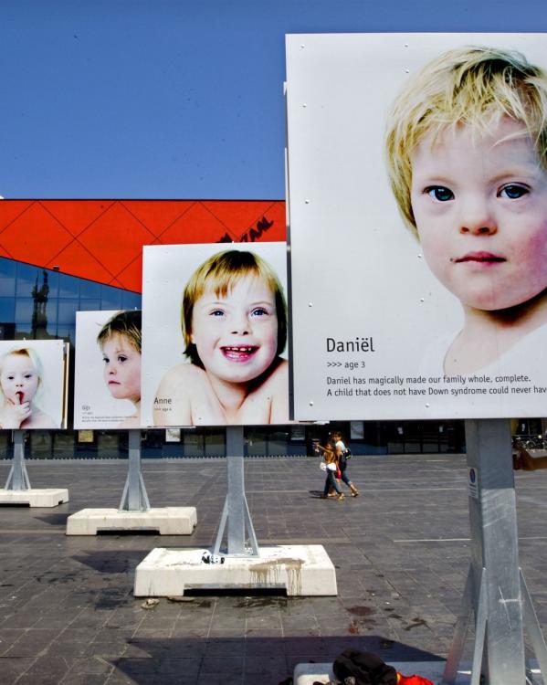 kinderen met het syndroom van down