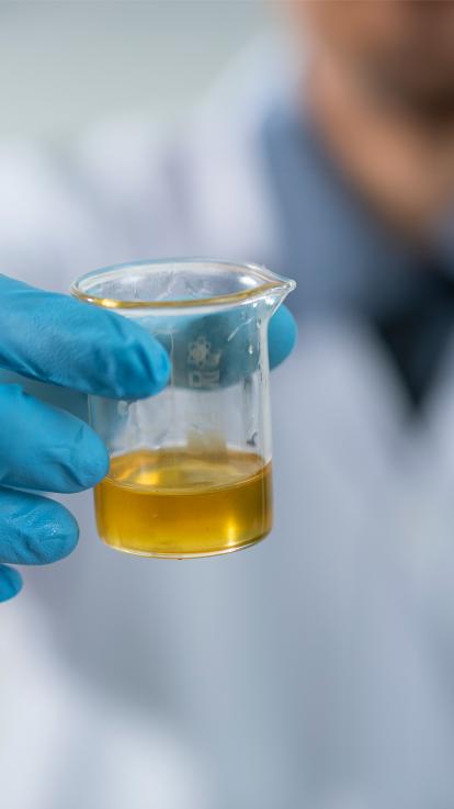 iemand houdt een potje met urine vast