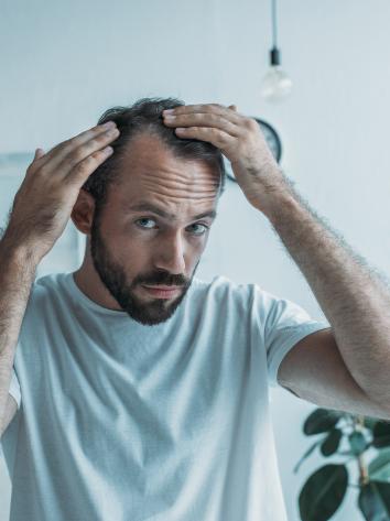 kalende man kijk in spiegel naar zijn beginnende kale inhammen