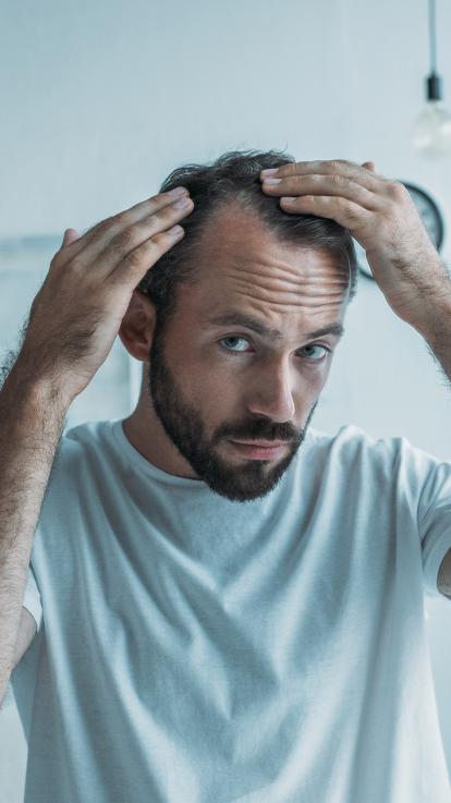 kalende man kijk in spiegel naar zijn beginnende kale inhammen