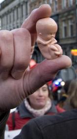 abortus_plasticfoetusmetkind