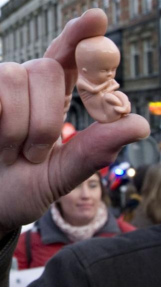 abortus_plasticfoetusmetkind