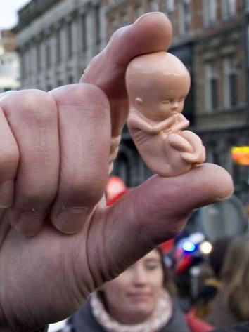 abortus_plasticfoetusmetkind