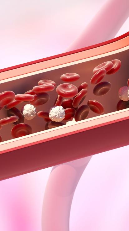 Door stolling van het bloed kan ader worden afgeloten