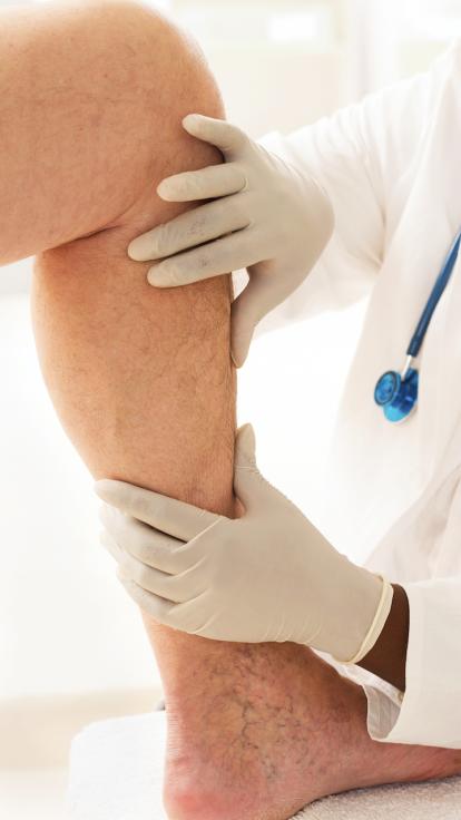 trombose in het been