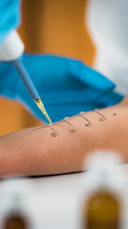 huidpriktest om te testen waarvoor je allergisch bent