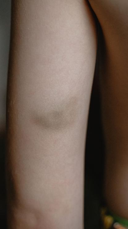 2_blauweplek_kindermishandeling