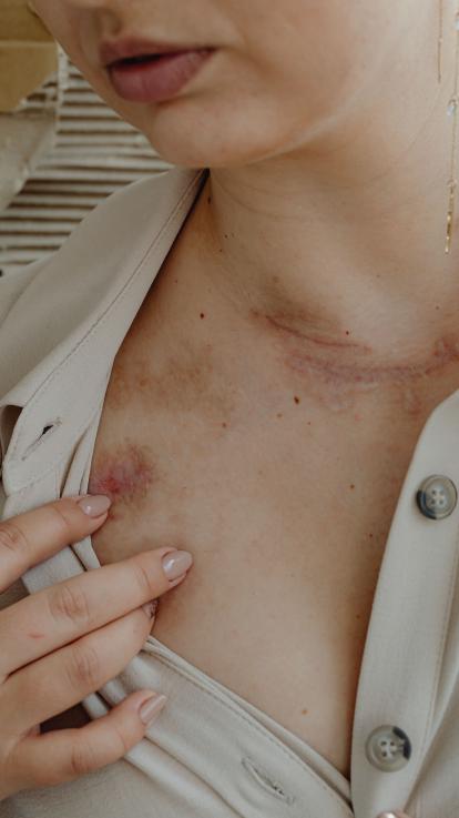 1_ruziende vrouwen_partnergeweld