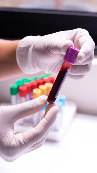 11_bloed_handschoenen