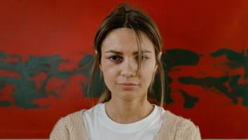 een vrouw met een blauw oog kijkt recht in de camera