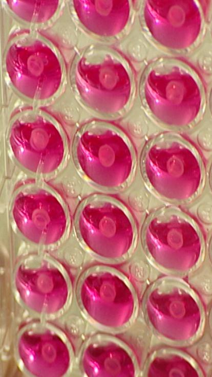 Het beginnetje van kweekvlees wordt gemaakt in een lab, met rode vloeistoffen