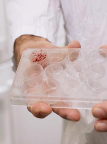 Petrischaaltje met kweekvlees erin!