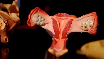 een model van een baarmoeder