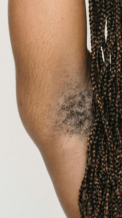 Oksel met zwarte haren.