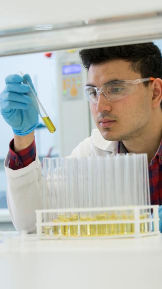 Man kijk in laboratorium naar buisjes met urine