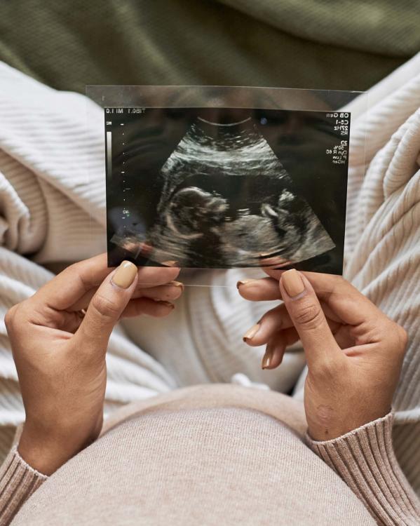 iemand houdt een echo-foto vast van de foetus