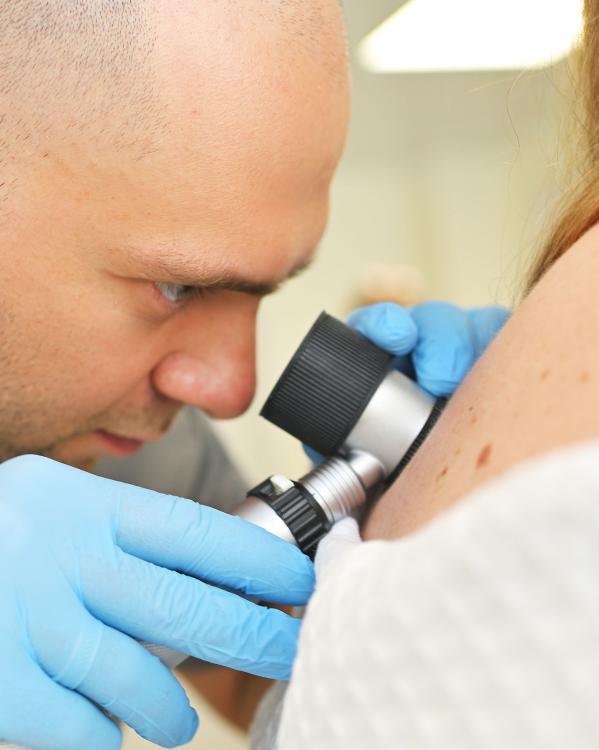 een dermatoloog onderzoekt een plekje op iemands huid