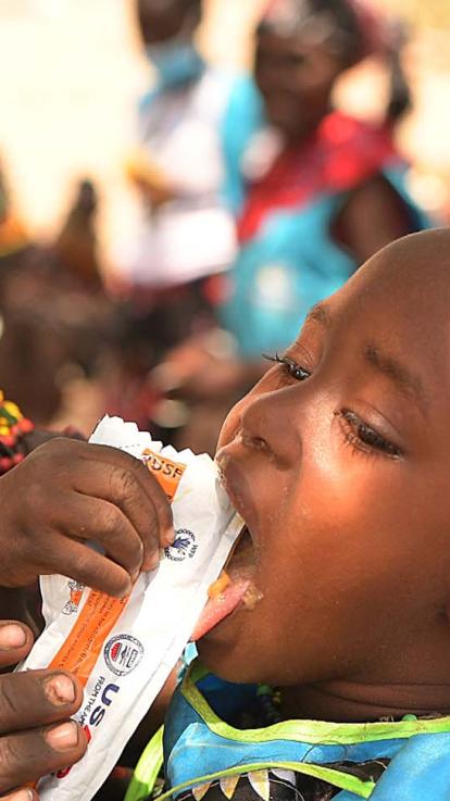 een klein ondervoed kind krijgt voeding via een zakje