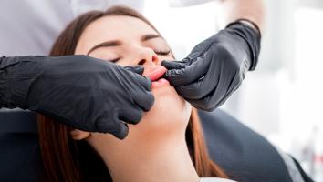 iemand krijgt een cosmetische behandeling voor haar lippen