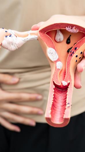 een vrouw houdt haar hand op haar buik en in de andere hand houdt ze een baarmoeder-model vast