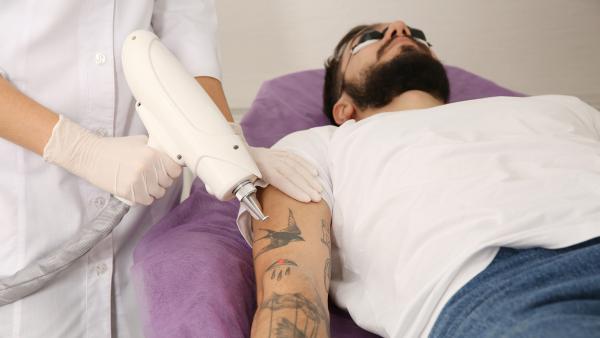 Man ligt met beschermbril op een behandelbank terwijl hand in doktershandschoen een lasergun op zijn tatoeages richt