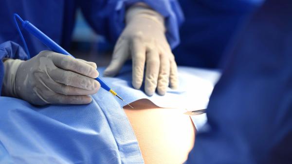 We zien de handen van een arts met een injectienaald in zijn hand, klaar om iemand te injecteren met een ruggenprik.