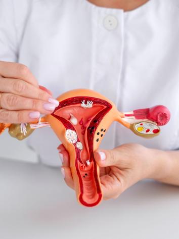 Een dokter houdt een anatomisch model van de baarmoeder in haar hand en wijst naar de eierstok.
