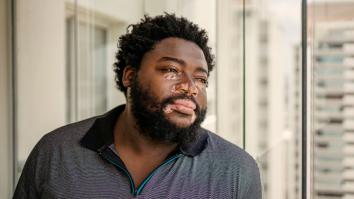 Een man met vitiligo kijkt uit het raam 