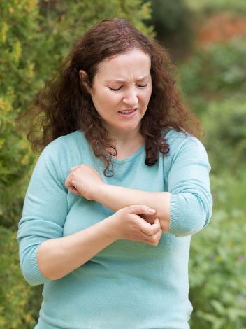 Een vrouw krabt aan een muggenbult op haar arm terwijl ze buiten loopt